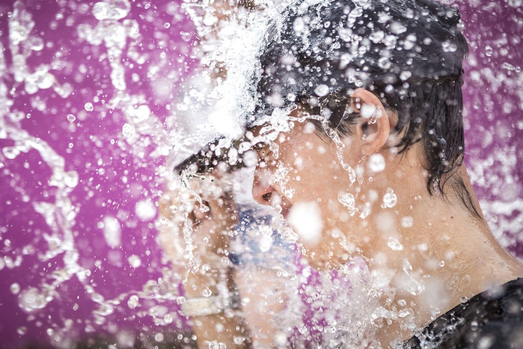 Hyperhidrose Behandlung